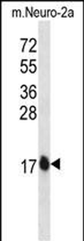 GATE16 Antibody (N-term)