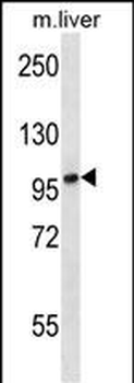TRPV6 Antibody (C-term)