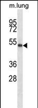 PBX2 Antibody (Center)