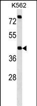 P2RX2 Antibody (N-term)