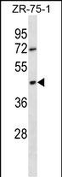 OR2T6 Antibody (C-term)