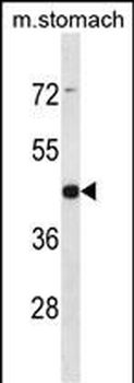 ARRDC1 Antibody (Center)