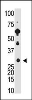 Recoverin Antibody (C-term)