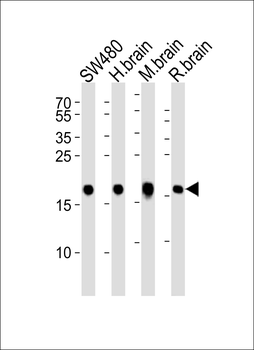 VILIP1 Antibody (C-term)