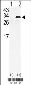 GJB6 Antibody (N-term)