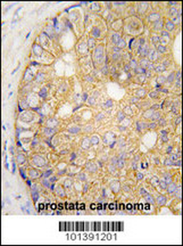 GJB6 Antibody (N-term)