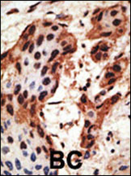 GJB6 Antibody (N-term)