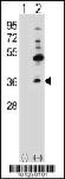 Connexin 30.3 Antibody (N-term)