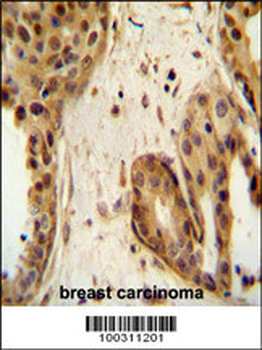 STAT2 Antibody (C-term)
