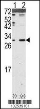 DKK2 Antibody (N-term)