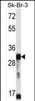 OR5D13 Antibody (Center)