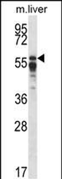 PPP2R5A Antibody (C-term)