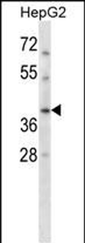 RAD51C Antibody (Center)