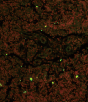 CD19 Antibody (N-term)