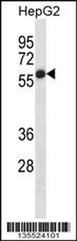 ALPP Antibody (N-term)