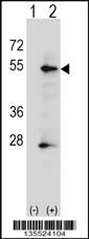 ALPP Antibody (N-term)