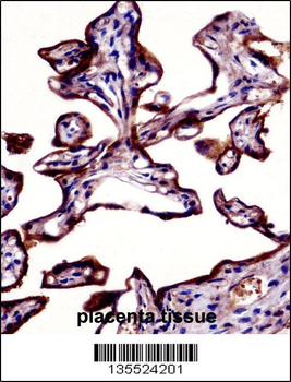 ALPP Antibody (N-term)