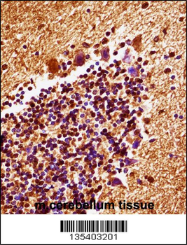 Mouse Map2k4 Antibody (C-term)