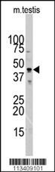 Actin (ACTB/ACTC) Antibody (N-term)