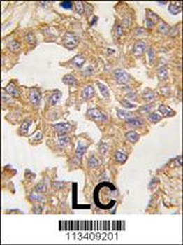 Actin (ACTB/ACTC) Antibody (N-term)