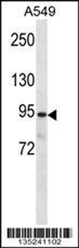 PKP3 Antibody (C-term)