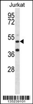RBM22 Antibody (Center)