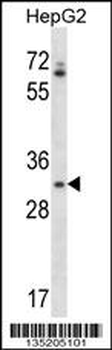 OR4Q3 Antibody (C-term)