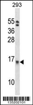 EIF1B Antibody (C-term)