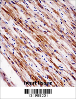 NR1D2 Antibody (Center)