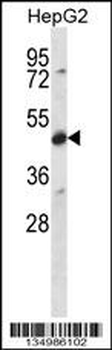 CDR2 Antibody (C-term)
