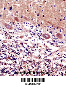CDR2 Antibody (C-term)