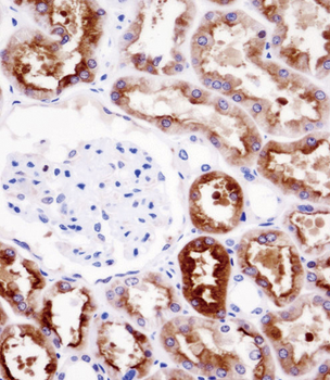 PDZK1 Antibody (Center)