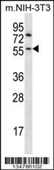 Mouse Gsk3b Antibody (N-term)