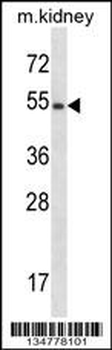 Mouse Frk Antibody (C-term)