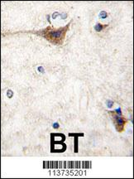 CDH10 Antibody (N-term)