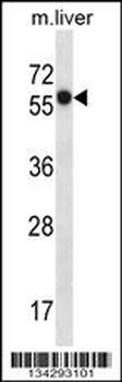 SLC45A3 Antibody (Center)