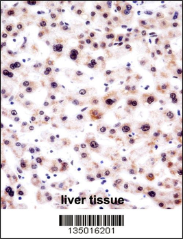 SNRPA Antibody (Center)