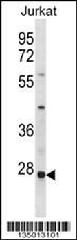 HTATIP2 Antibody (N-term)