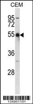 KCNA2 Antibody (C-term)