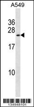 KCNMB1 Antibody (Center)