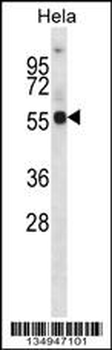 KCNA1 Antibody (Center)