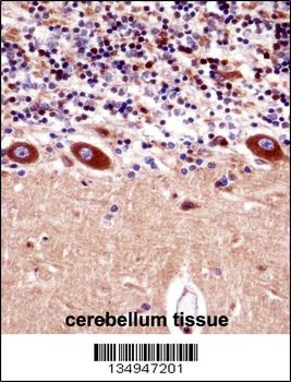 KCNA1 Antibody (Center)