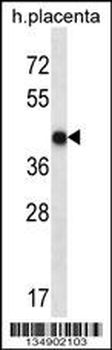 OR10V1 Antibody (C-term)