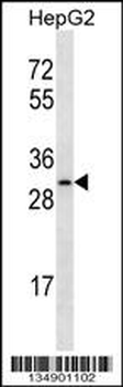 OR4C12 Antibody (C-term)