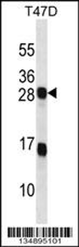 KDELR2 Antibody (C-term)