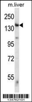 Mouse Eif2ak4 Antibody (C-term)