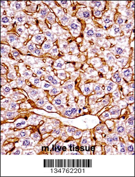 Mouse Eif2ak4 Antibody (C-term)