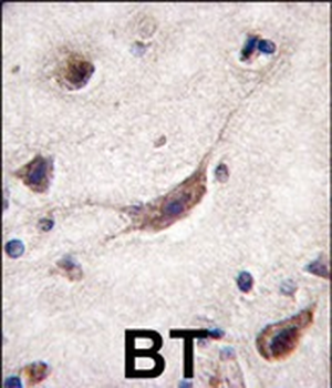 ERAS Antibody (N-term) (A28)