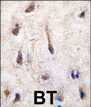 ERAS Antibody (N-term) (F66)