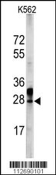 ERAS Antibody (N-term)